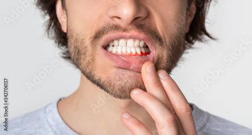Man suffering from toothache, tooth decay or sensitivity photo