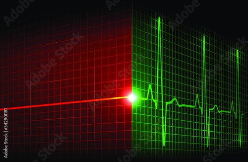 Cardiac arrest and heart beating again. Heart rate graph. Ekg icon wave. Electrocardiogram. Red and green color. 3D. Stock vector illustration.