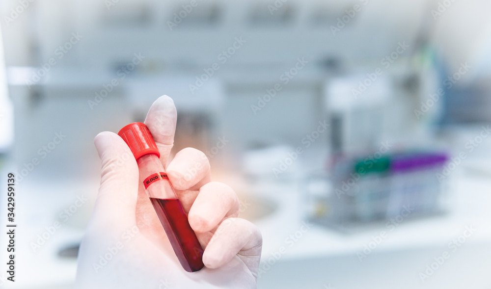 hand of a person holding test tube in laboratory with blurred background, Corona virus and science laboratory concept