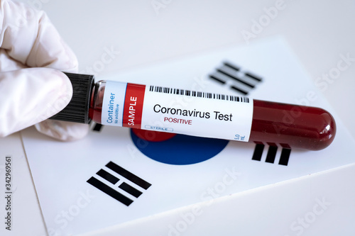 Testing for presence of coronavirus. Tube containing a blood sample that has tested positive for COVID-19. Flag of South Korea in the background. photo