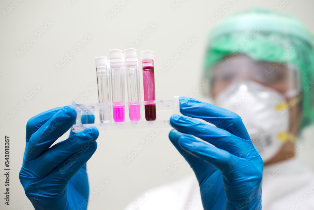 Coronavirus Covid 19 infected blood sample coronavirus covid 19 research laboratory, Coronavirus Covid-19 vaccine research Coronavirus Covid 19 infected blood sample coronavirus covid 19 research laboratory, Coronavirus Covid-19 vaccine research