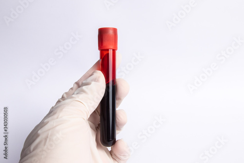 Close up of doctor hand holding blood sample. Medical concept image