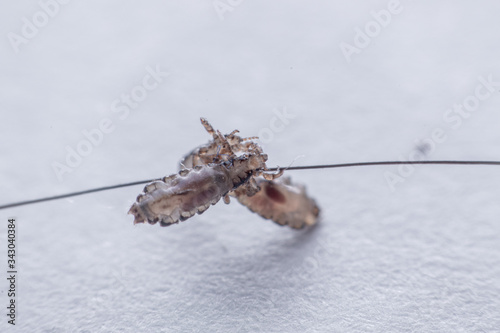 Macro Close Up Pediculus humanus capitis head louse photo