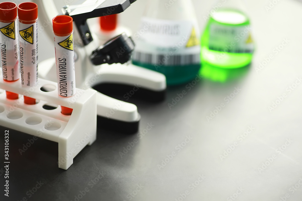 A blood sample for testing the dangerous virus coronavirus in the body. Test tubes with tests for coronavirus. Laboratory studies of viral diseases. A blood sample for testing the dangerous virus coronavirus in the body. Test tubes with tests for coronavirus. Laboratory studies of viral diseases.