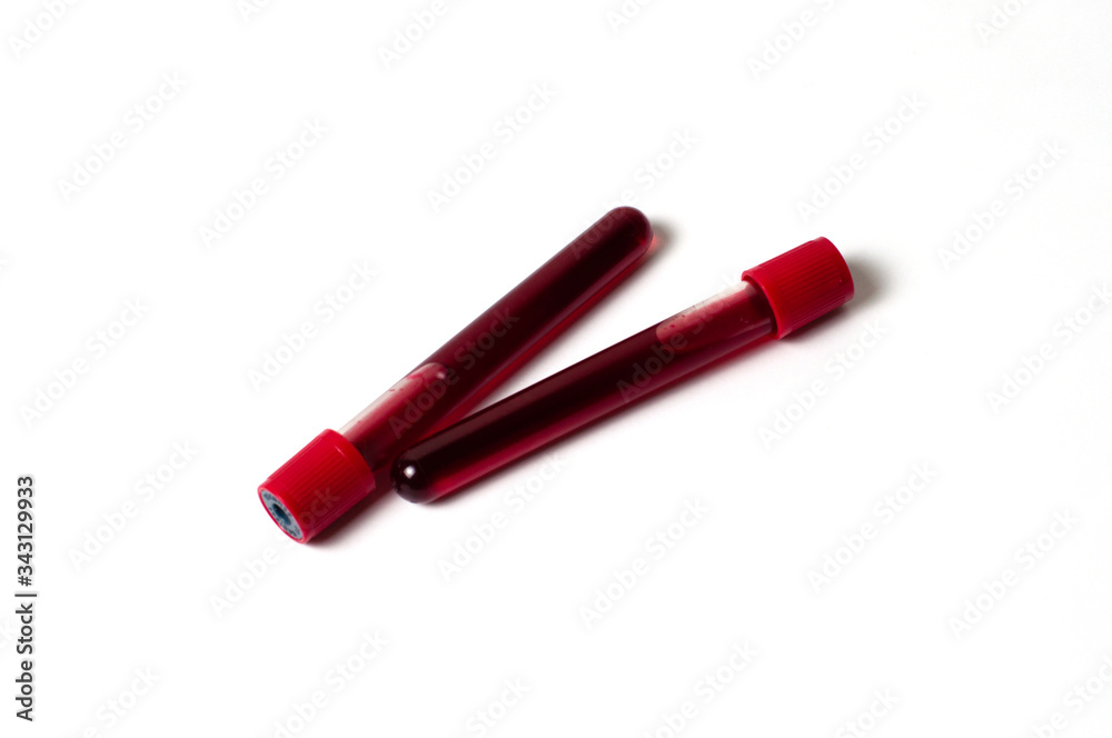 Two test tubes with blood isolate on a white background. The concept of medicine, the fight against viruses and bacteria, diseases Two test tubes with blood isolate on a white background. The concept of medicine, the fight against viruses and bacteria, diseases