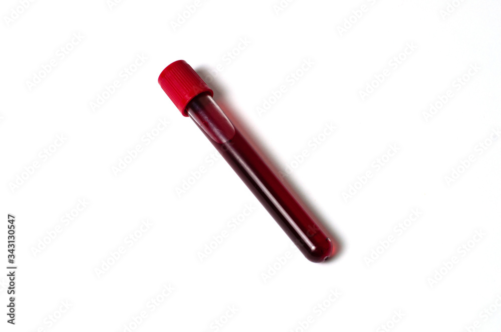 Test tube with blood isolate on a white background Test tube with blood isolate on a white background