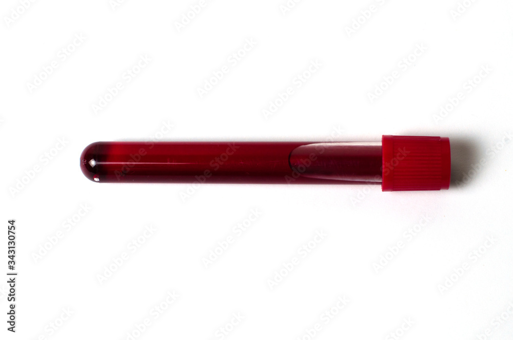 Test tube with blood isolate on a white background Test tube with blood isolate on a white background
