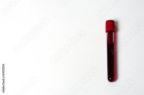 Test tube with blood isolate on a white background