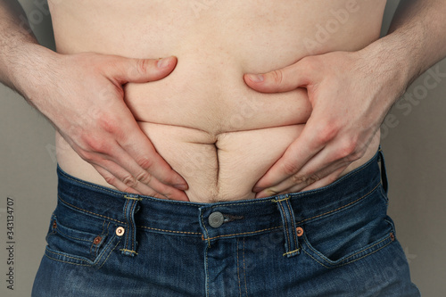 Man in jeans hold his fat belly. Weight gain