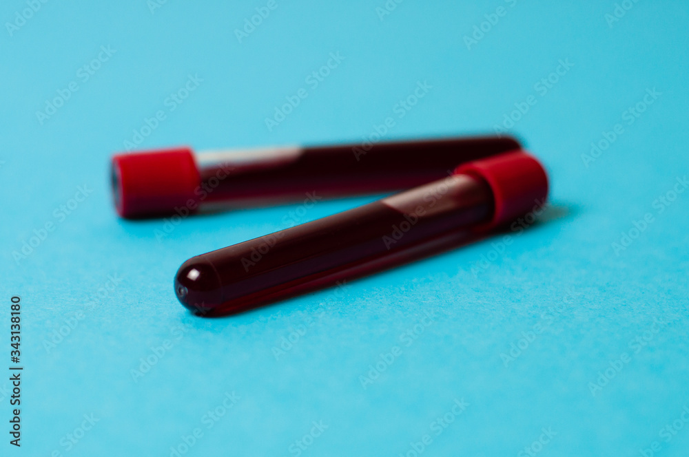 Two test tubes with blood isolate on blue background. The concept of medicine, the fight against viruses and bacteria, diseases Two test tubes with blood isolate on blue background. The concept of medicine, the fight against viruses and bacteria, diseases