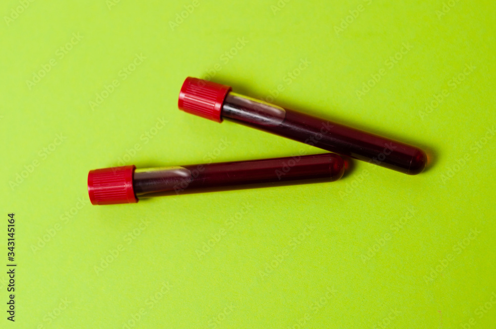 Two test tubes with blood isolate on green background. Concept medicine, the fight against viruses and bacteria, diseases Two test tubes with blood isolate on green background. Concept medicine, the fight against viruses and bacteria, diseases