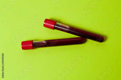 Two test tubes with blood isolate on green background. Concept medicine, the fight against viruses and bacteria, diseases
