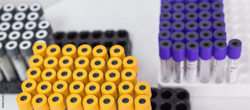 Many test tubes with blood being tested. Coronavirus and covid-19 concept. Many test tubes with blood being tested. Coronavirus and covid-19 concept.