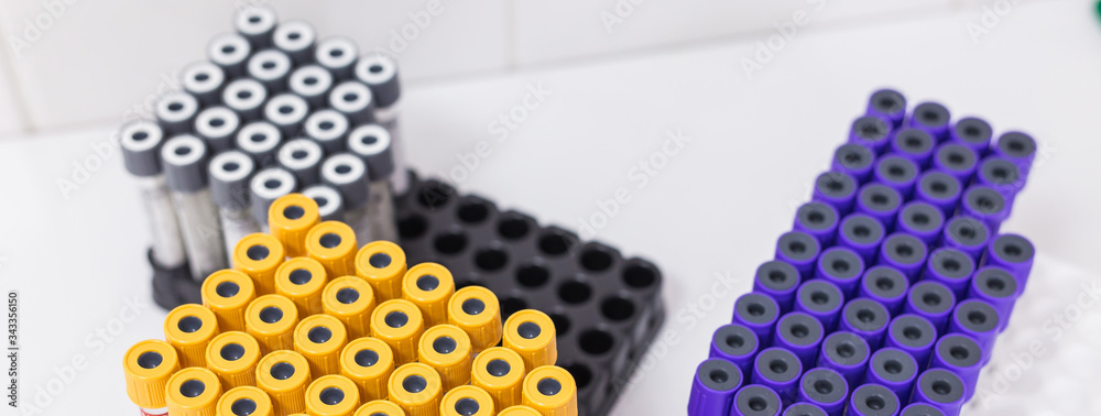 Many test tubes with blood being tested. Coronavirus and covid-19 concept. Many test tubes with blood being tested. Coronavirus and covid-19 concept.