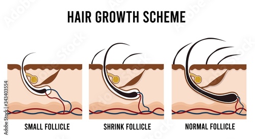 Hair Growth Scheme