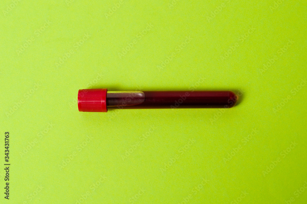 Test tube with blood isolate on a green background Test tube with blood isolate on a green background