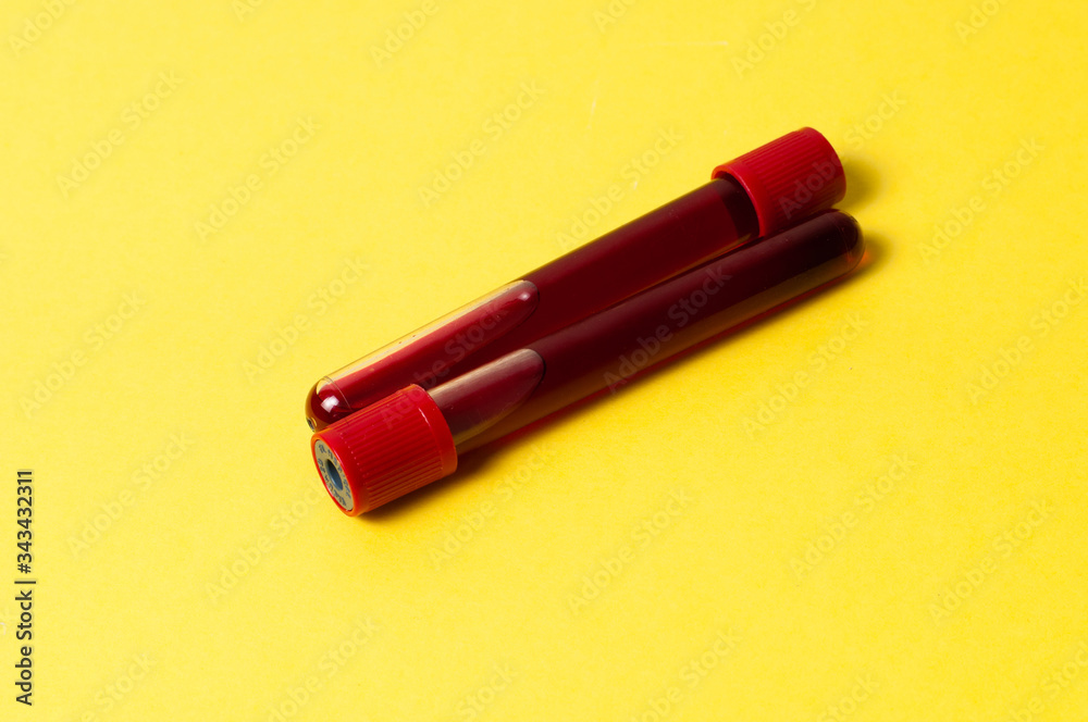 Two test tubes with blood isolate on yellow background. Concept medicine, the fight against viruses and bacteria, diseases Two test tubes with blood isolate on yellow background. Concept medicine, the fight against viruses and bacteria, diseases