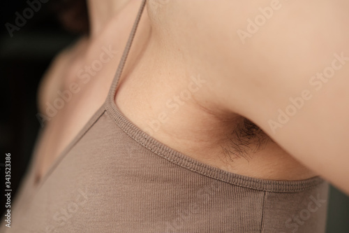 Cuadro en lienzo Hairy, unshaven female armpits in natural light