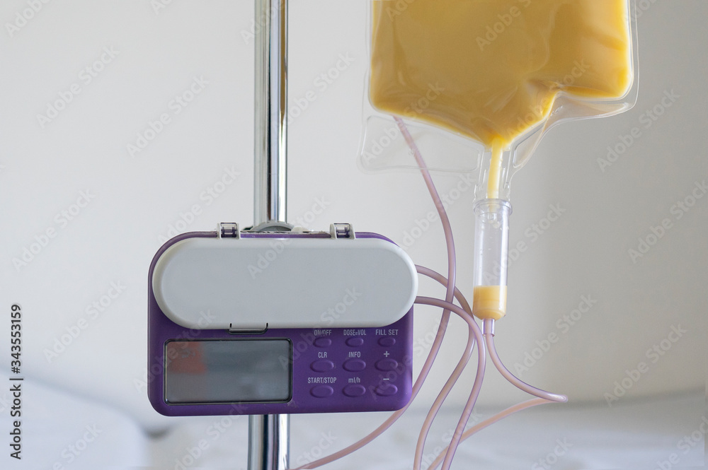 Feeding Pump medical device purple color to supplement nutrition liquid