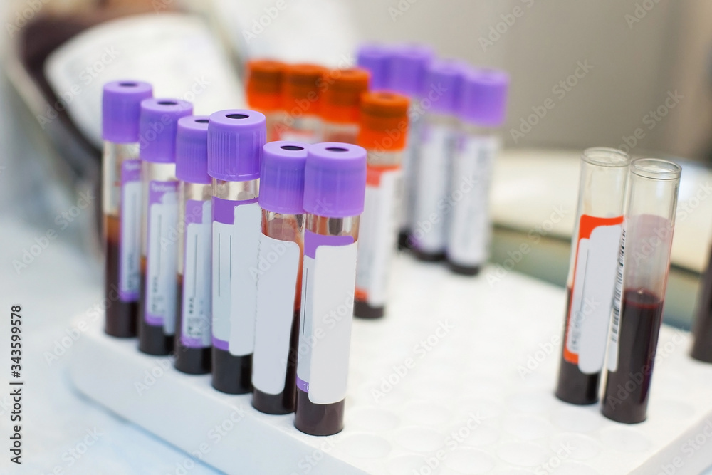 color-coded medical test tubes, filled with venous blood from different patients and ready for some researches. 