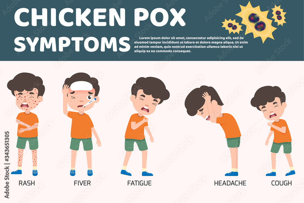 Children has chicken pox infographic, Poster children fever and chickenpox  symptoms and prevention. Health care and medical cartoon character vector  illustration. Virus and bacteria sign elements. Stock Vector | Adobe Stock