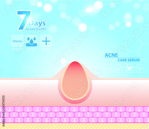 Three main layer of the human skin. skin aging stages diagrams, ollagen and elastin progressive decrease close up, skincare infographics. Illustration about medical diagram.