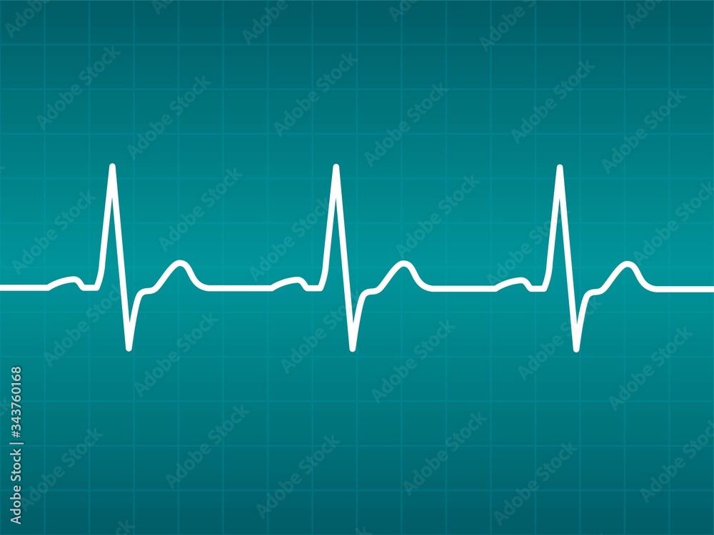 Graphic material representing an electrocardiogram Graphic material representing an electrocardiogram