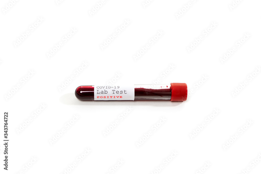 Test tube containing a blood test sample over white background