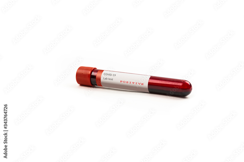 Test tube containing a blood test sample over white background