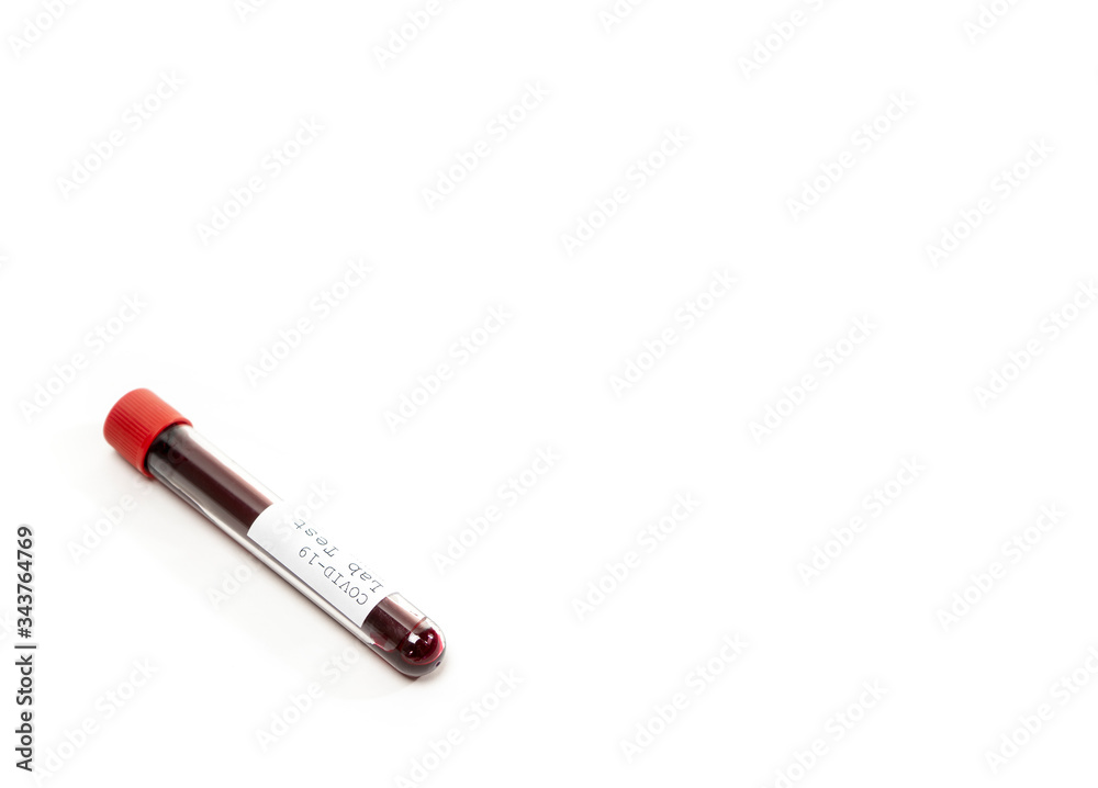 Test tube containing a blood test sample over white background