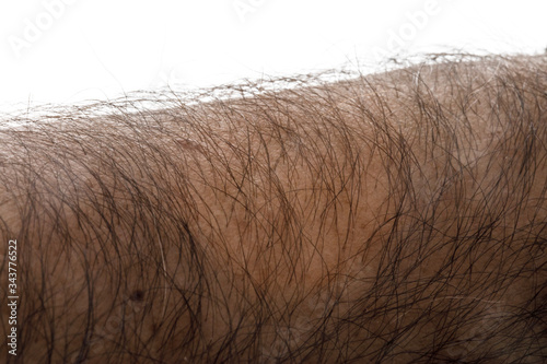 Porzione di braccio umano con peli , isolata su sfondo bianco photo