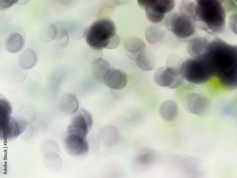 custom made wallpaper toronto digitalbacteria under microscope blood cells, concept virus covid-19 or coronavirus