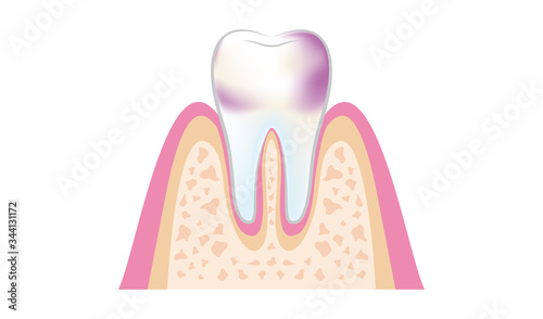 dental_pmtc_step02