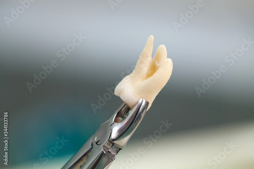 Fototapeta Tooth extraction