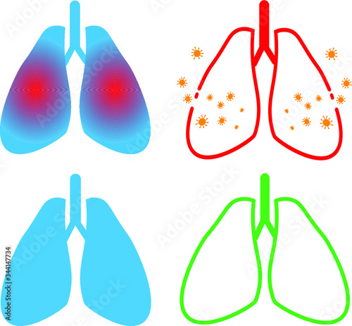 lungs, illustrations of healthy lungs and those affected by the virus, terrible lung lesion by coronavirus