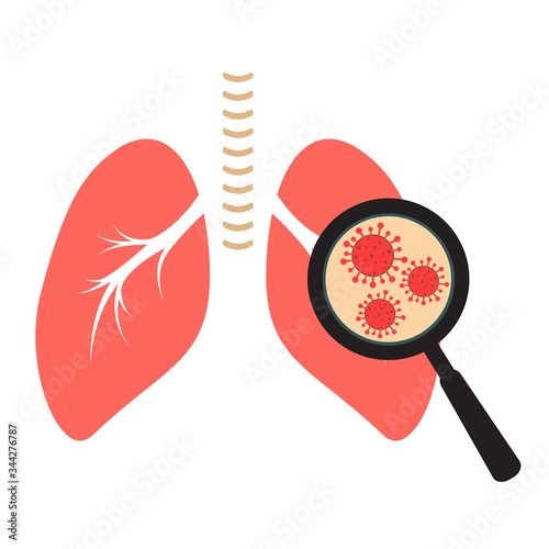 Coronavirus or bacteria  in human lugs. Vector illustration.