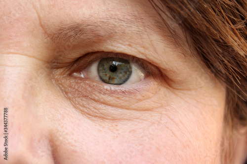 green eye with brown spots on the face of an elderly woman, small wrinkles on the eyelids, overhang, the concept of age-related changes in human skin