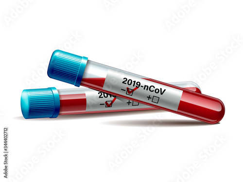 Test tube with blood sample for COVID-19, Coronavirus test.