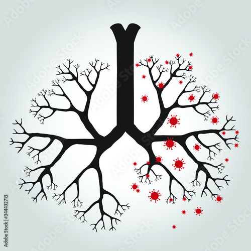 Cornona virus in lungs 