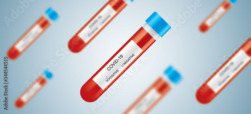COVID-19 blood test tubes, hanging in the air. Corona virus vector medical background. Laboratory glass capsules with white information labels and analysis answers.