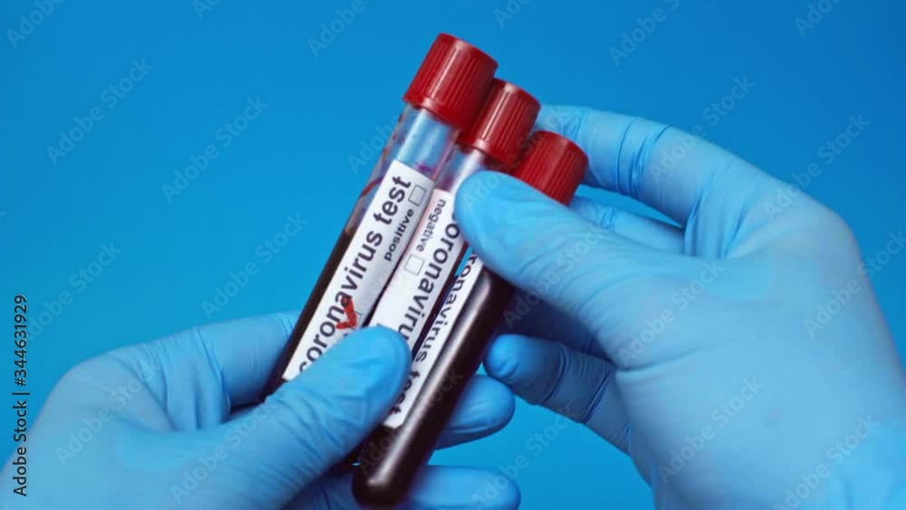 partial view of doctor showing coronavirus tests tubes isolated on blue partial view of doctor showing coronavirus tests tubes isolated on blue