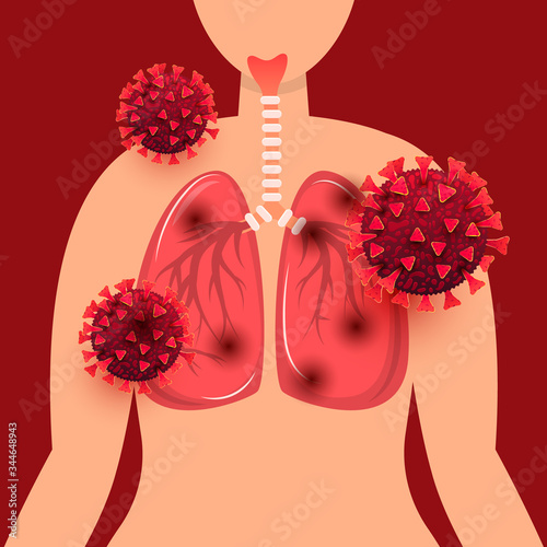 Human lungs infected with coronavirus infection concept. Covid 19 outbreaking and pandemic medical health