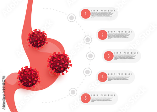 Human stomach hurts with coronavirus cells infographics design on a white background. Covid 19 infection concept.