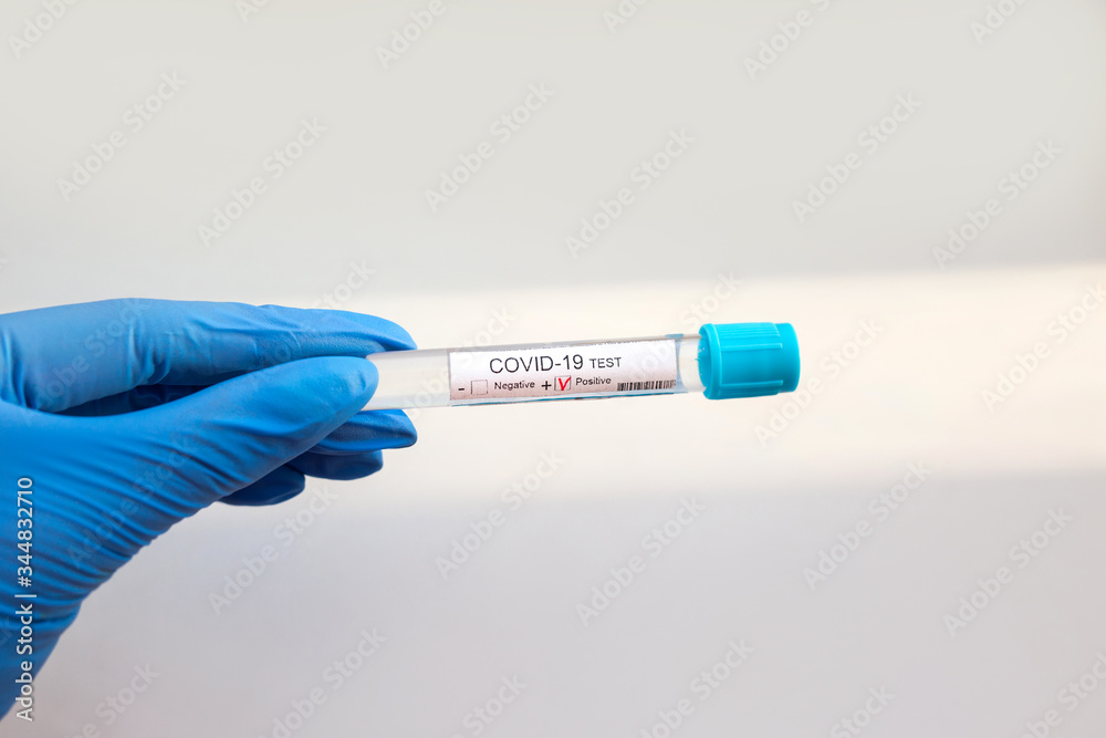 Obraz premium Coronavirus test in doctors hand on white background