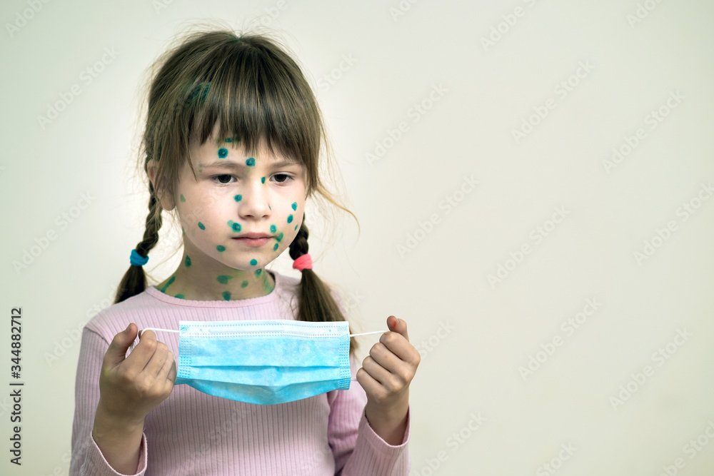 Child girl wearing blue protective medical mask ill with chickenpox, measles or rubella virus with rashes on body. Children protection during epidemic of coronovirus. Covid-19 contagion concept.