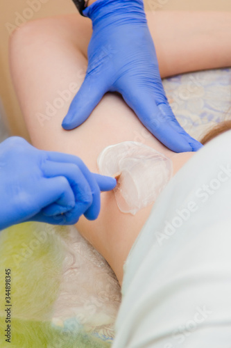 Closeup hands of the depilation master in blue rubber gloves apply hot wax with a wooden spatula to the client's armpit. Armpit hair removal preparation.