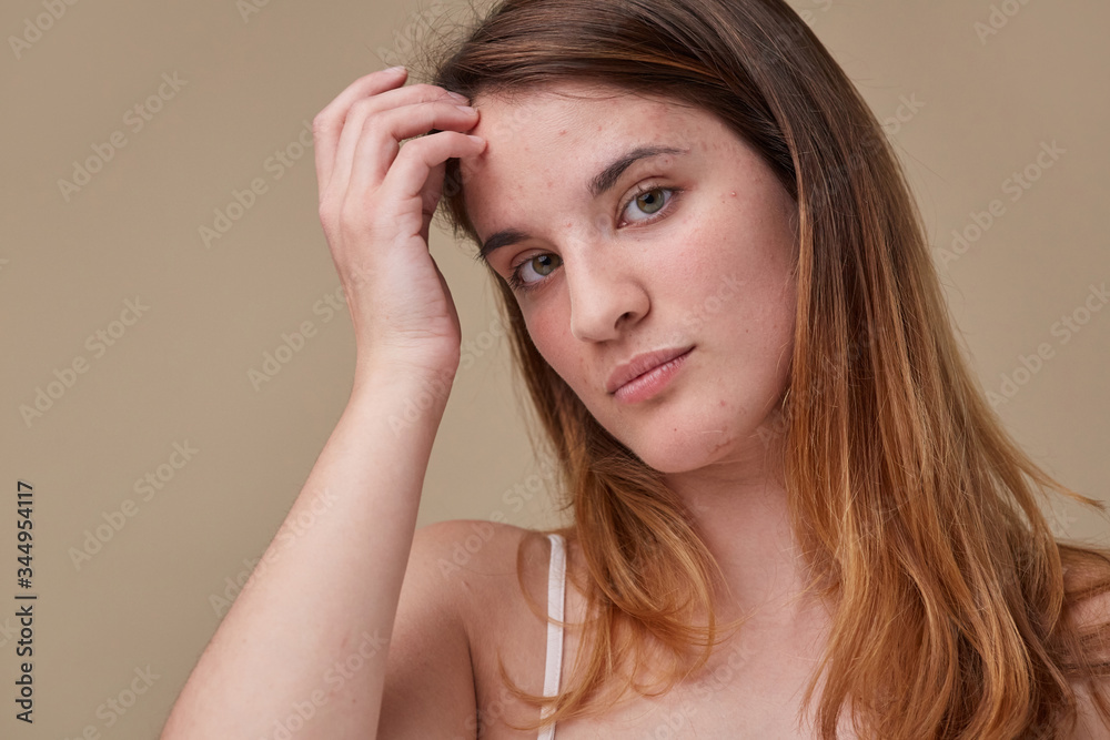 Unretouched skin with pimples Unretouched skin with pimples