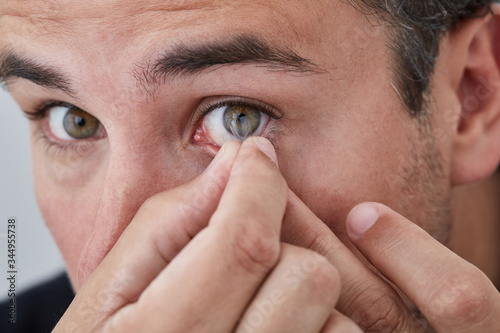 Man inserting contact lens
