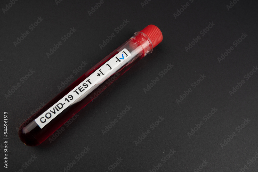 Corona virus blood test concept: A test tube with NEGATIVE COVID-19 result on black background with copy space Corona virus blood test concept: A test tube with NEGATIVE COVID-19 result on black background with copy space