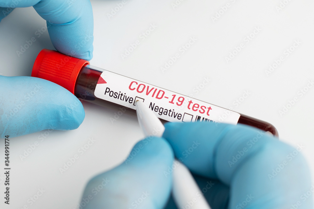 Obraz premium Doctor putting check mark near inscription positive on test-tube. Coronavirus epidemic